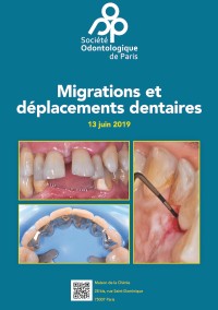 Migrations et déplacements dentaires